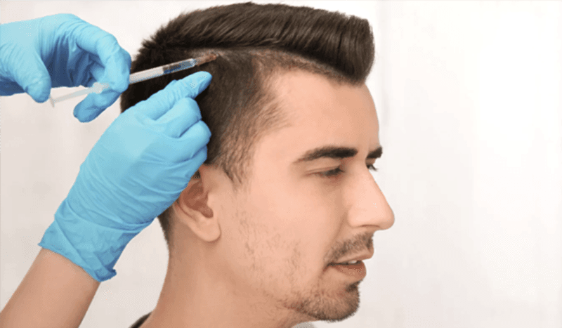 sac-prp-uygulamalari