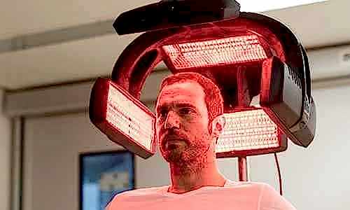 sac-ekimi-nasil-yapilir