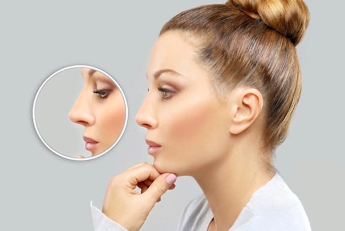 Rhinoplasty (Nose Aesthetics)